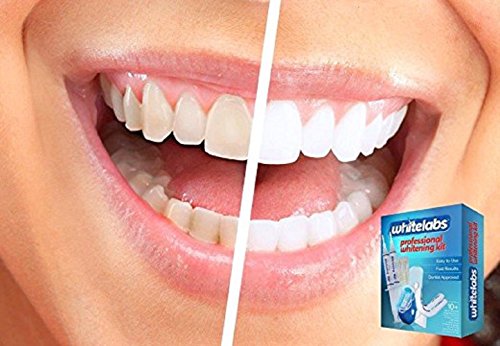 Whitelabs домашен комплет за белење на заби