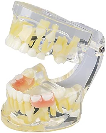 KH66ZKY Дете листопаден модел на држачи за заби - модел на заби на заби - алатка за демонстрација на четкање за заби за учење на