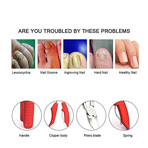 Ножици За Нокти На ноктите На нозете Лесни Клешти датотека За Калус За Пилинг За Омекнување На Кожата За Мажи