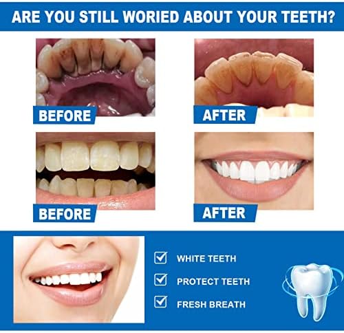 Заби за белење на заби, 3 парчиња 10 ml професионални заби Белење на патување пријателски заболувања за стоматолошка орална орална