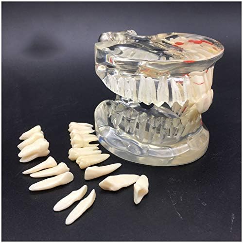 KH66ZKY Стомален стандарден патолошки отстранлив модел на настава за заби, патологија на возрасни заби заби
