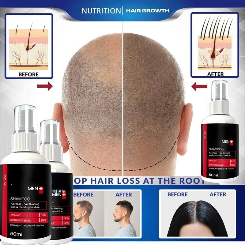 Растителна Суштина На Косата Поправка Оштетени Фоликули На Косата Спречување На Губење На Косата Третман Брз Раст Негување Сува