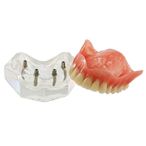 Dentalmall Dental Gurn Implants Model Предоставување со 4 супериорни заби демо транспарентна визија за едукација и алатка за модели на студии M6001 C