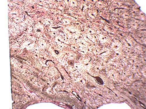 Компактна Коска, Подготвени Микроскоп Слајд-75 х 25мм-Анатомија, Биологија &засилувач; Микроскопија-Еиско Лаборатории
