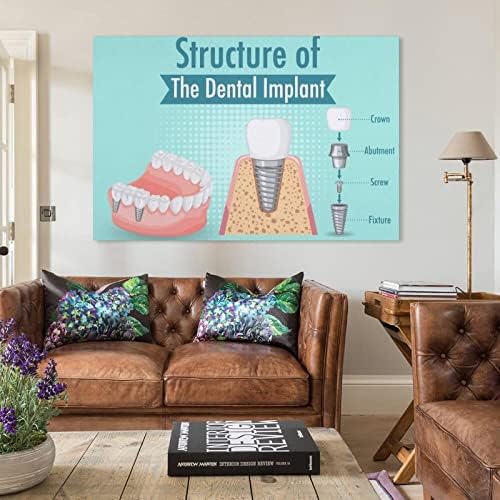 Постери Стоматолошка имплантација Постер за стоматолошка клиника Постер Медицинска болница Научна постер платно платно печатење на wallидни уметности за wallидни де