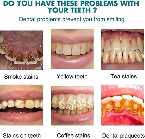 Боја за заби, инстант белење на белење за заби, лак за белење на заби, лак за боја, инстант силна силна бела заби за отстранување на дамки за сите