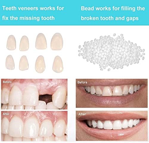 Комплет за привремено поправка на забите за привремено поправање на исчезнати и скршени лажни заби со заби и комплет за замена на термички монистра
